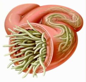 Parasites in guts