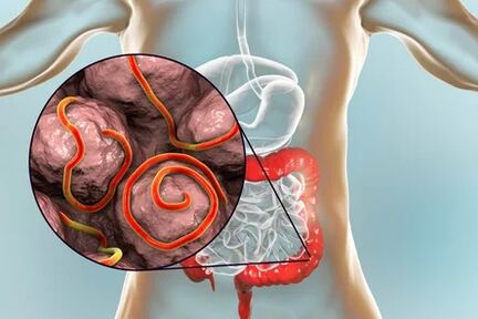 Parasites in guts