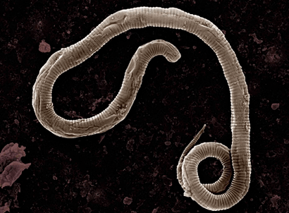 Where do worms come from in the human body